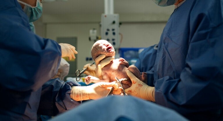 Medical professionals in surgical attire are delivering a newborn baby via emergency c-section in an operating room. One holds the infant while the other clamps the umbilical cord. The newborn is crying and covered in vernix, surrounded by medical equipment.
