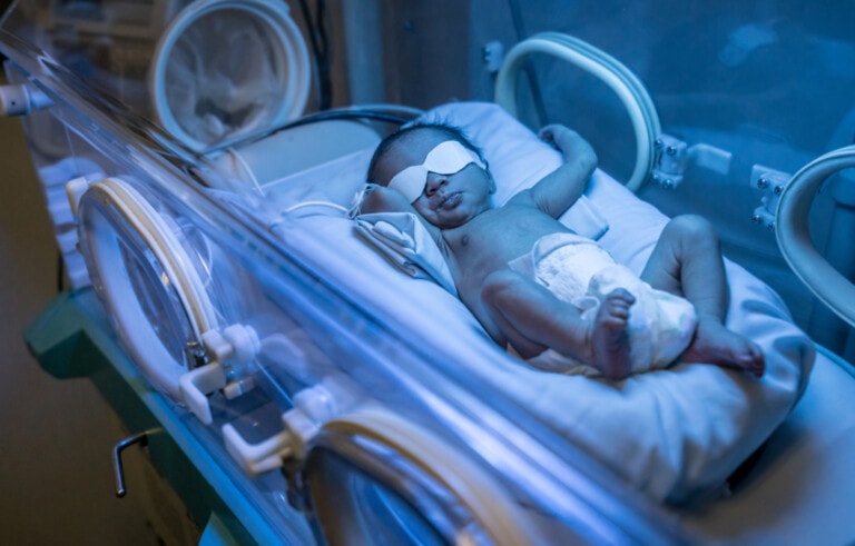 A newborn baby lies inside an incubator with an eye mask covering both eyes. The baby, wearing a diaper, is undergoing blue light therapy to treat neonatal jaundice and manage bilirubin levels in newborns. The incubator has circular ports and medical equipment is visible in the background.