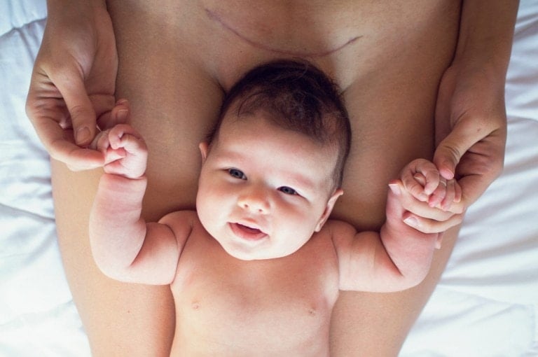 A baby is lying on a person's legs with the person's hands holding the baby's hands. The baby is looking up and smiling. The person, who appears to be in c-section recovery, has a scar on their lower abdomen.