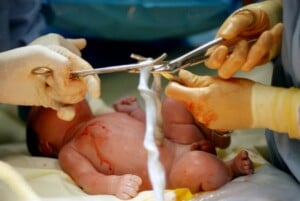 Two medical professionals wearing gloves are shown performing delayed cord clamping while cutting a newborn's umbilical cord with a clamp and scissors. The newborn, lying on a yellow sheet, is partially covered in blood. The background is blurred but suggests a clinical setting.