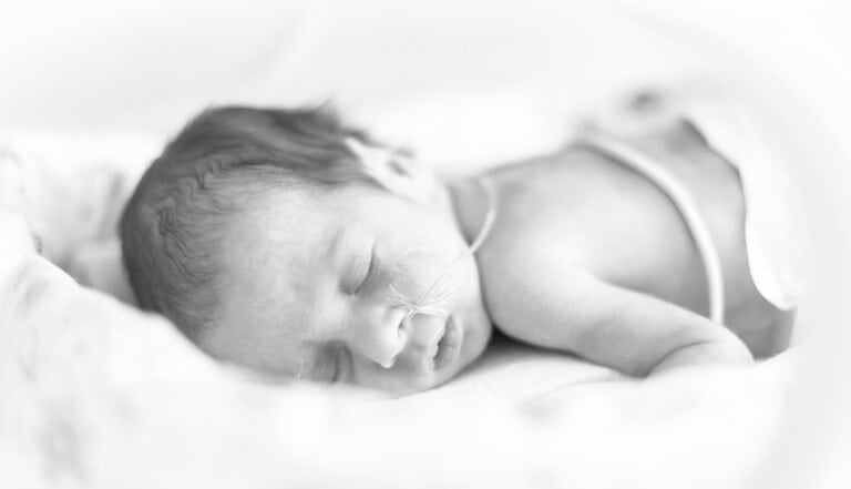 A black and white image of a sleeping newborn baby lying on its side. The baby, born preterm, has curly hair and a breathing tube attached to its nose. The background is soft and out of focus.